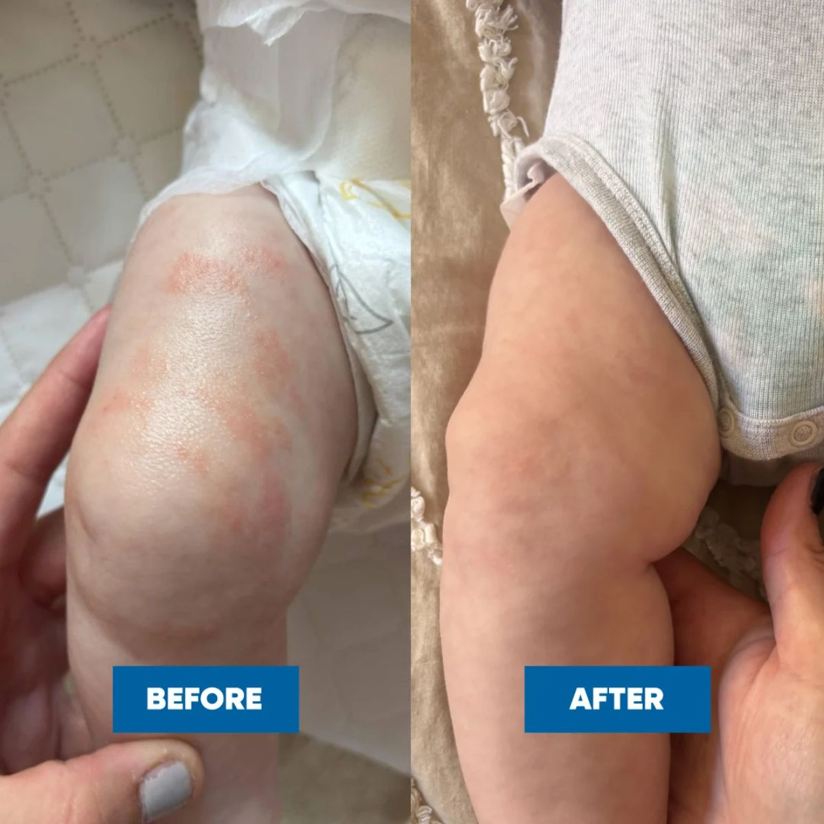 MooGoo - Pink Eczema Cream with Vitamin B12 & Nigella Sativa Oil